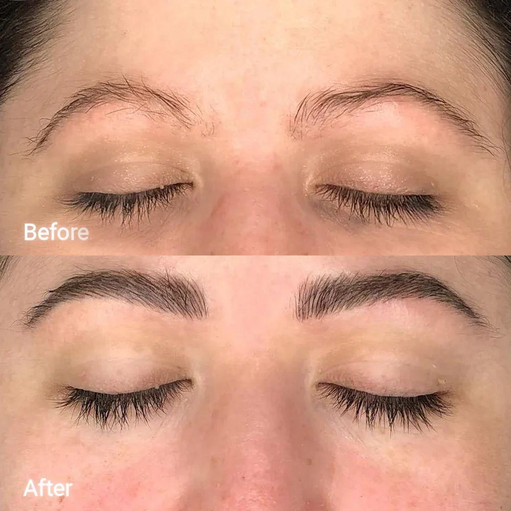 Féline Anti Eye Bag Roller
