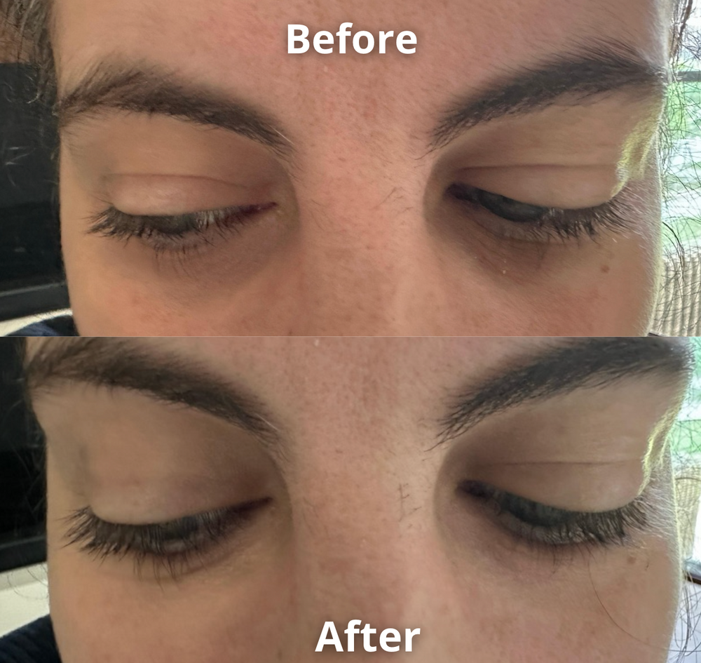 Féline Anti Eye Bag Roller