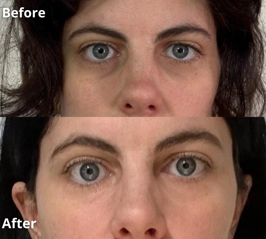 Féline Anti Eye Bag Roller