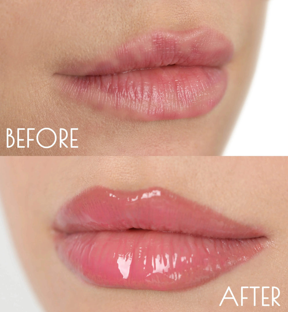 Lip Booster Active Micro Needle Roller