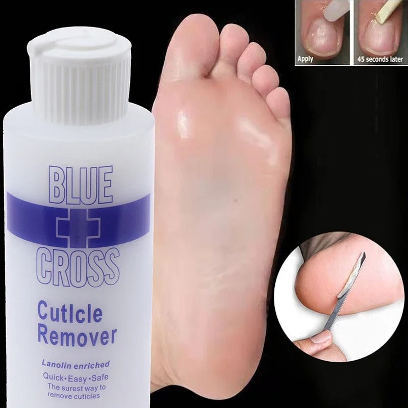 Foot Cuticle Remover & Exfoliating Softener – Dead Skin & Callus Removal 177ml
