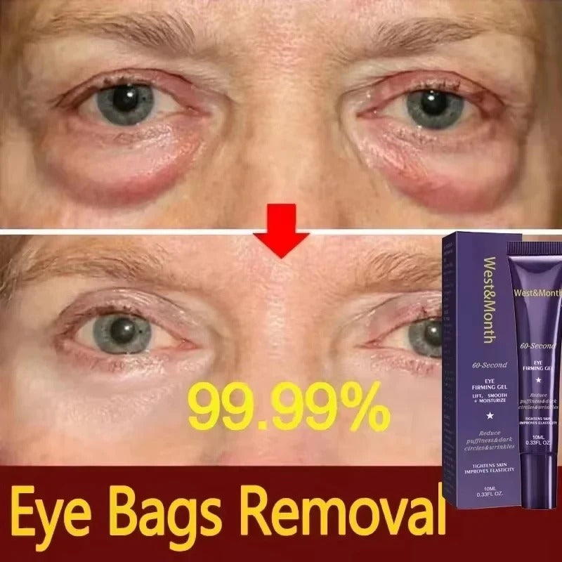 Instant Eye Bag Removal Cream