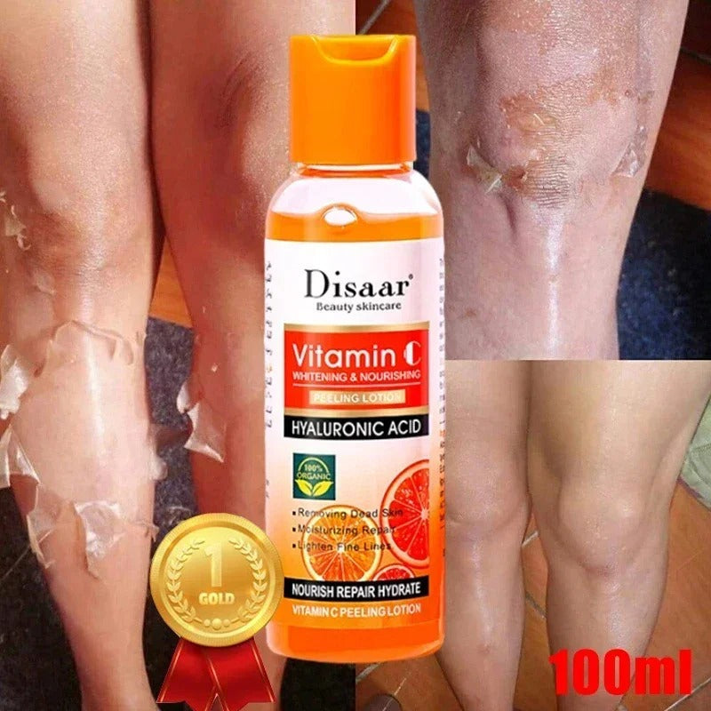 Organic Yellow Peeling Lotion for Whitening and Exfoliating Skin