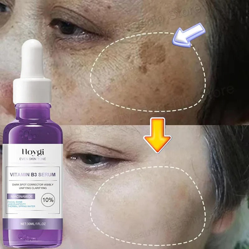 Dark Spot Remover Whitening Serum – Anti-Pigmentation & Brightening