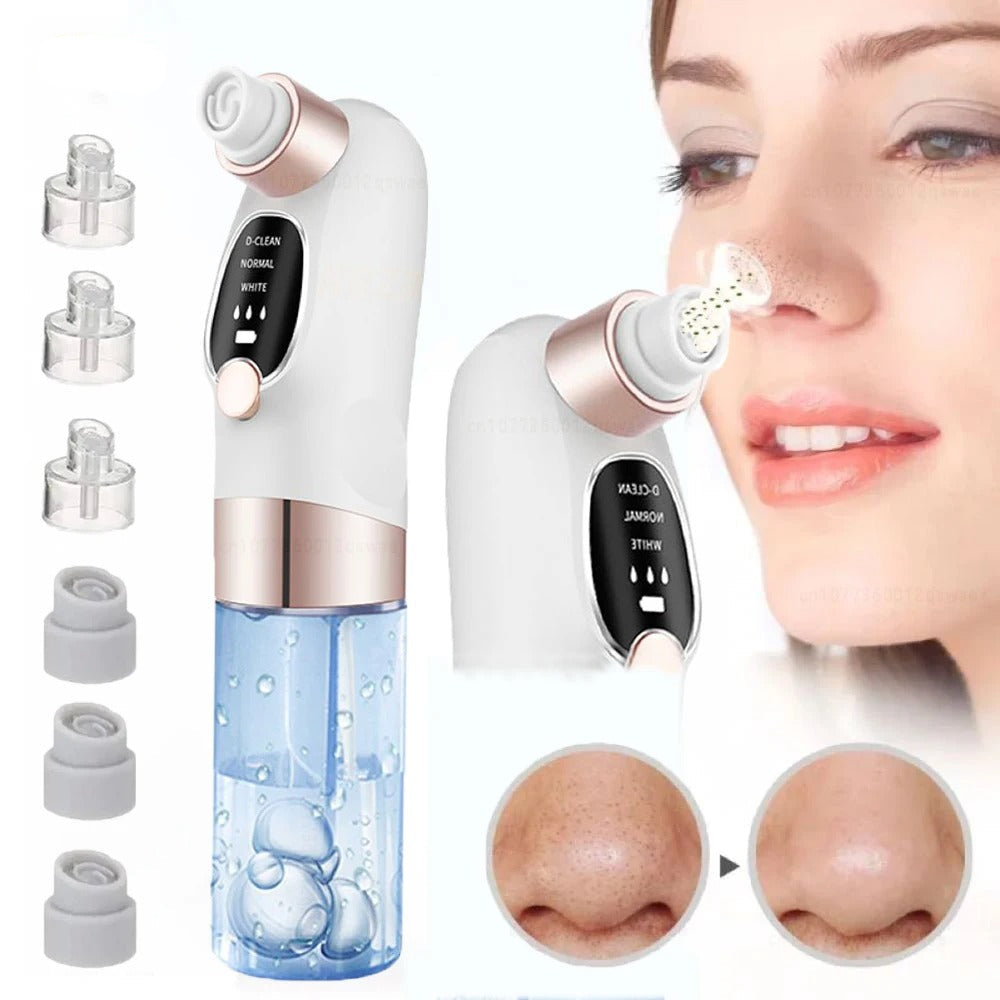 Electric Blackhead Remover Vacuum with Water Cycle System