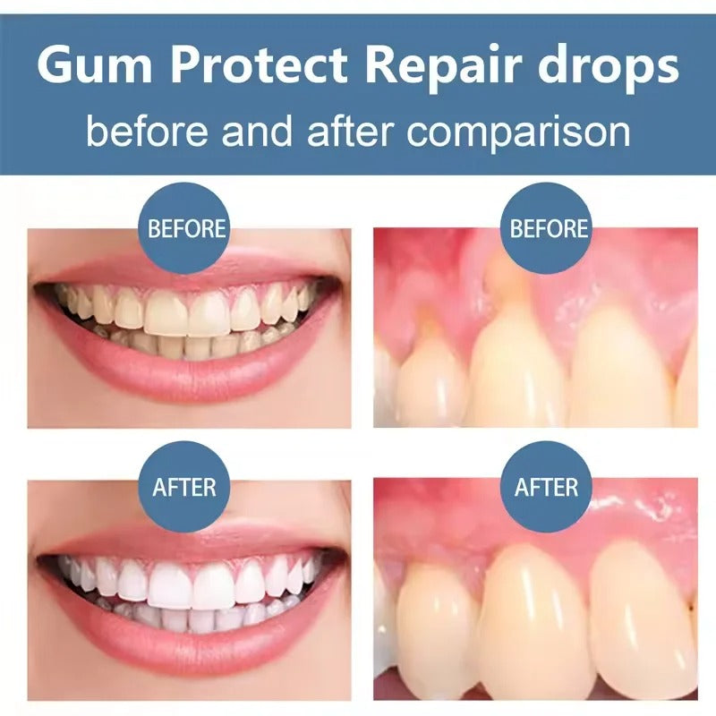Gum Repair Gel for Sensitive Gums and Tartar Removal