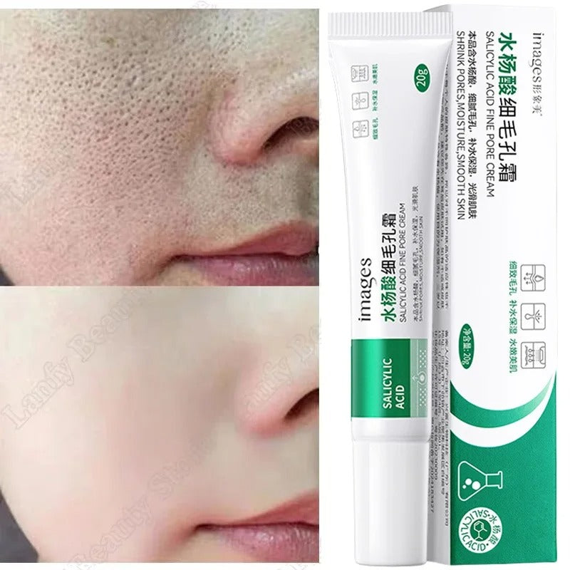 Salicylic Acid Pore Clearing Cream – Blackhead & Acne Removal Moisturizer