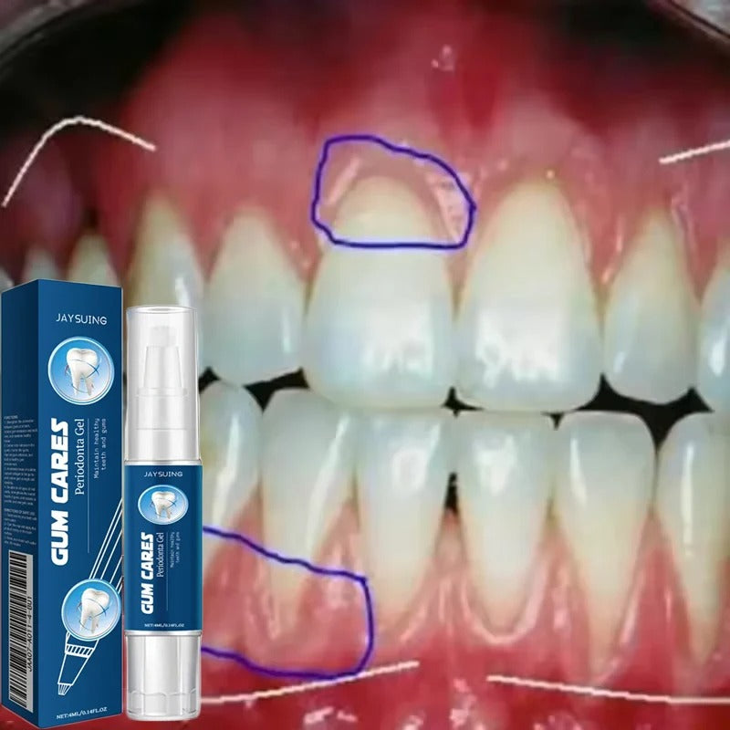 Gum Repair Gel for Sensitive Gums and Tartar Removal