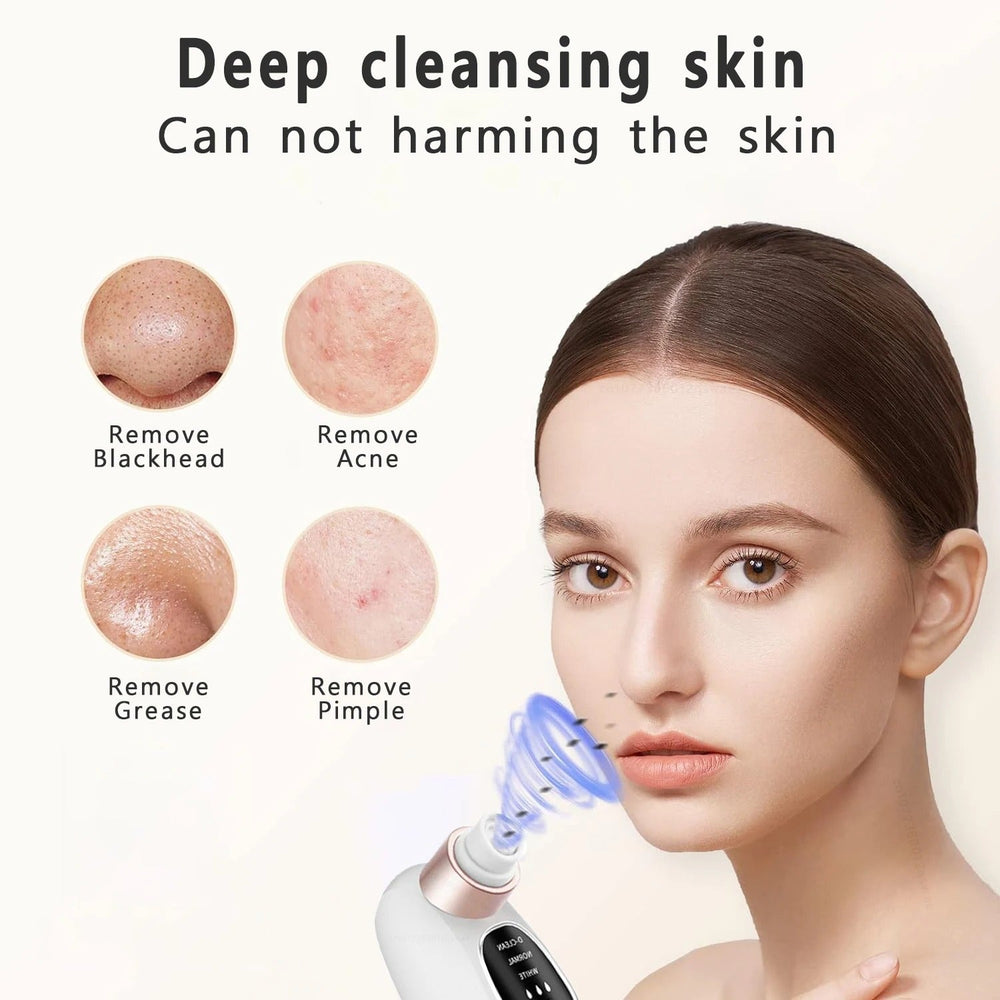 Electric Blackhead Remover Vacuum with Water Cycle System