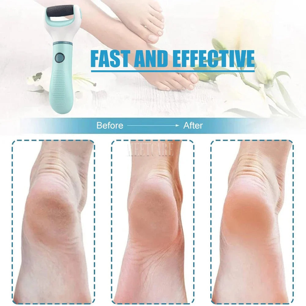 Electric Foot Grinder – Wireless Waterproof Pedicure Tool