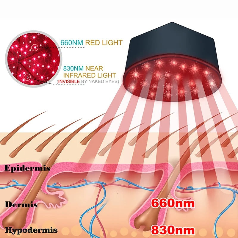 Red Light Therapy Cap – Infrared LED Hair Growth Helmet