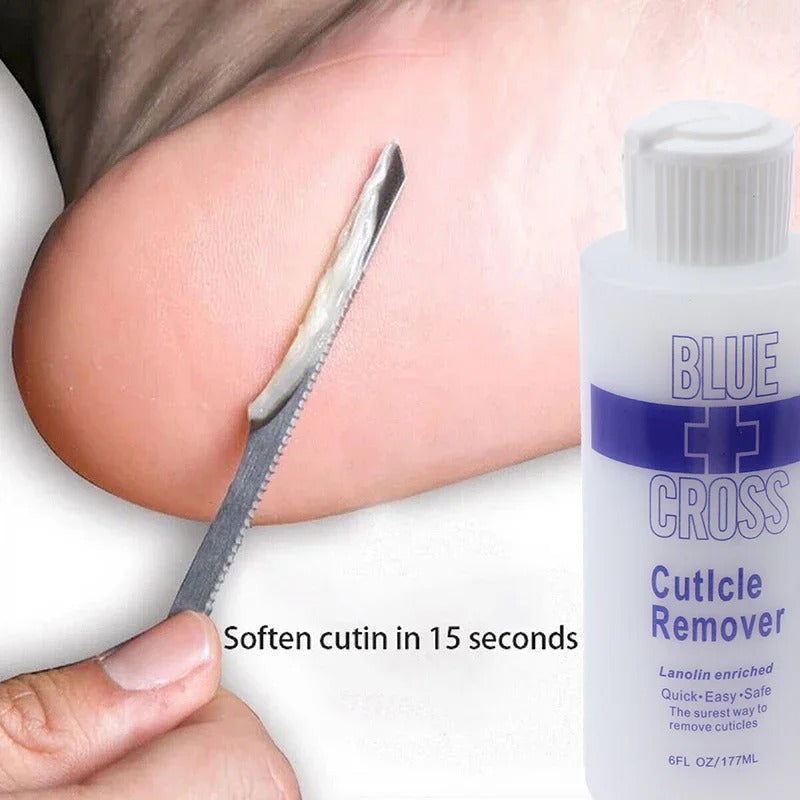 Foot Cuticle Remover & Exfoliating Softener – Dead Skin & Callus Removal 177ml