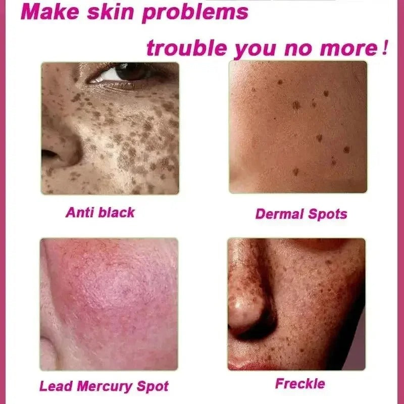 Dark Spot Remover Whitening Serum – Anti-Pigmentation & Brightening