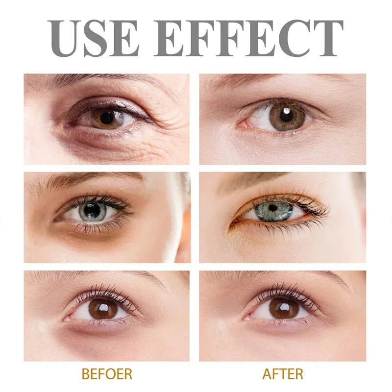 Instant Eye Bag Removal Cream