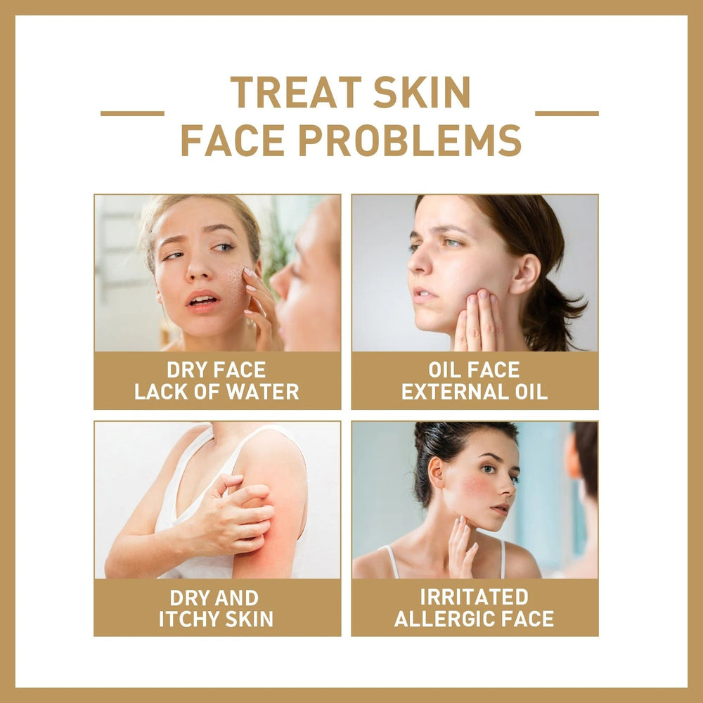 Rice Facial Toner – Moisturizing, Brightening & Skin Barrier Repair