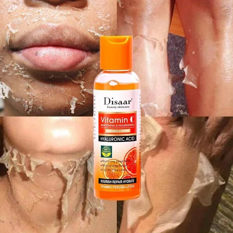 Organic Yellow Peeling Lotion for Whitening and Exfoliating Skin