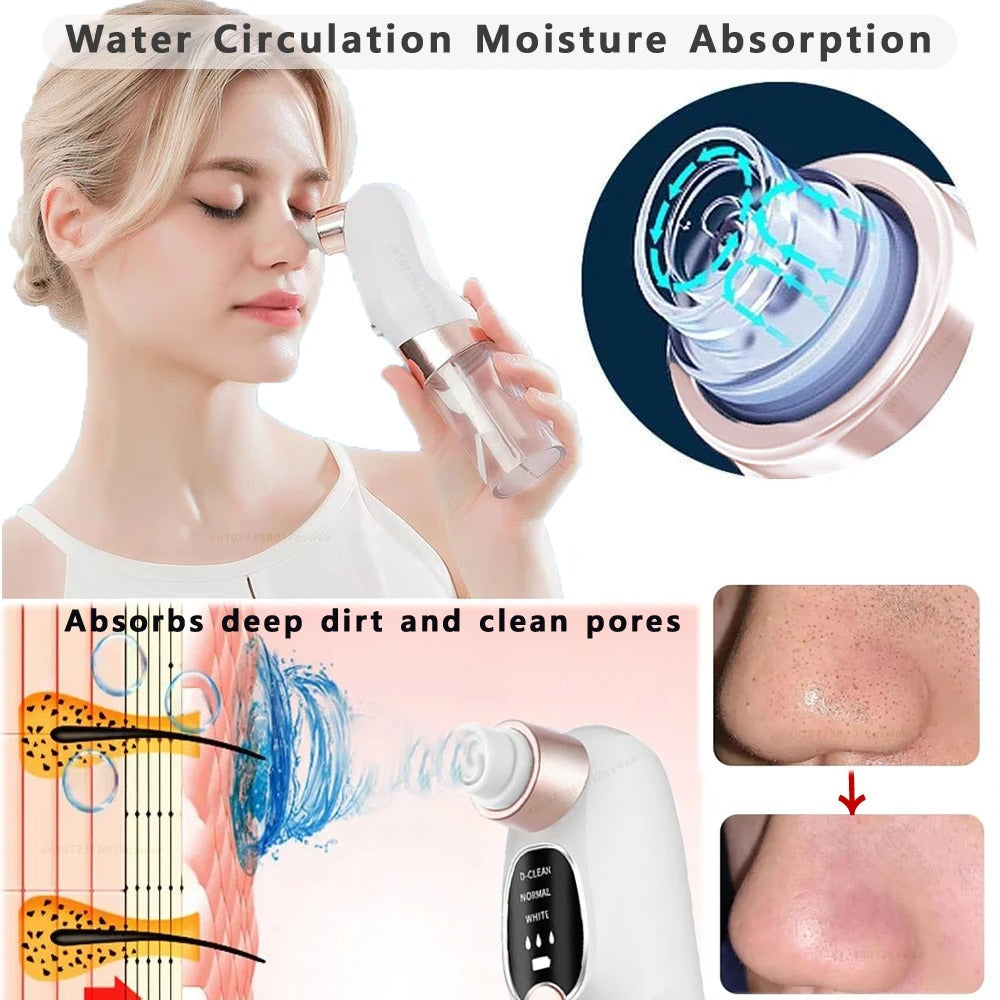 Electric Blackhead Remover Vacuum with Water Cycle System