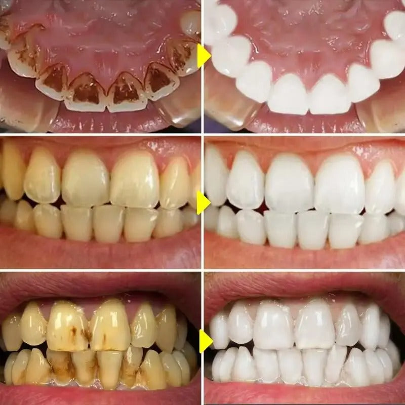 Instant Teeth Whitening Powder