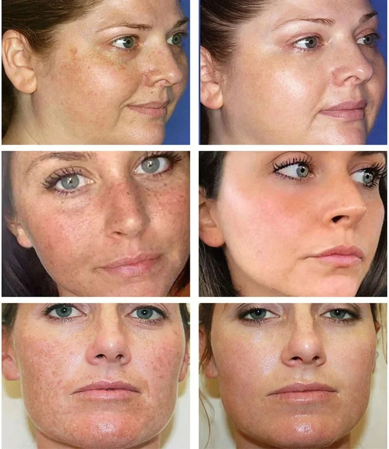 Dark Spot Remover Whitening Serum – Anti-Pigmentation & Brightening