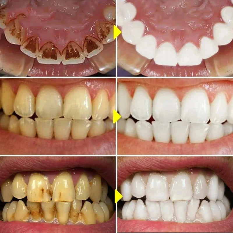 Instant Teeth Whitening Toothpaste
