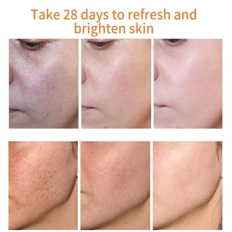 Dark Spot Remover Whitening Serum – Anti-Pigmentation & Brightening