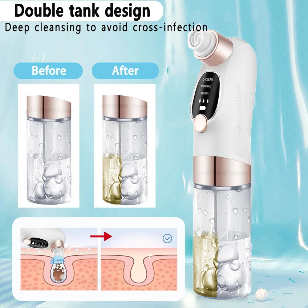 Electric Blackhead Remover Vacuum with Water Cycle System
