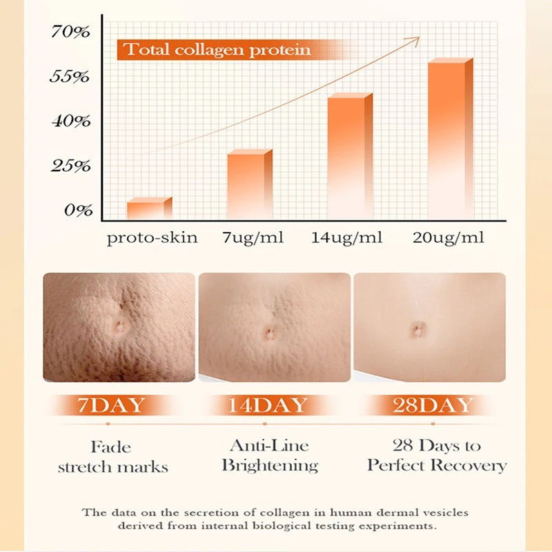 Stretch Mark Removal Cream – Repair, Firm & Smooth Skin