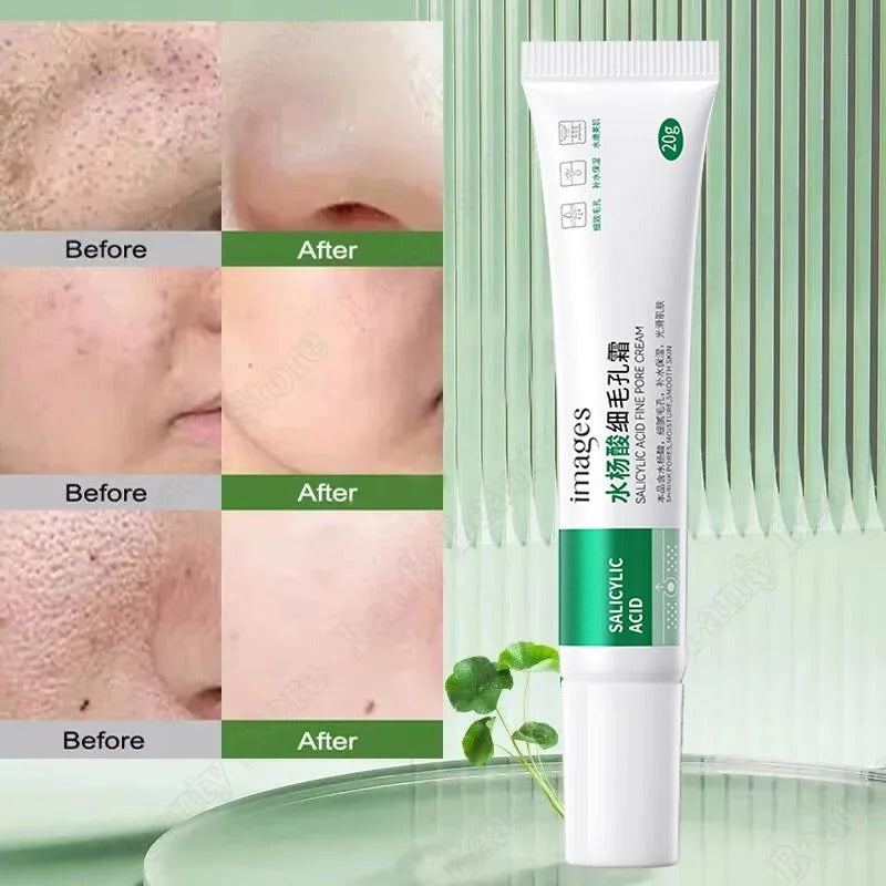 Salicylic Acid Pore Clearing Cream – Blackhead & Acne Removal Moisturizer