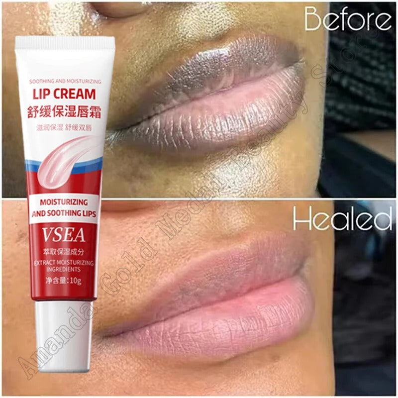 Dark Lip Lightening Balm – Pink Lip Exfoliator & Moisturizer for Dead Skin, Lip Line Fading & Hydration
