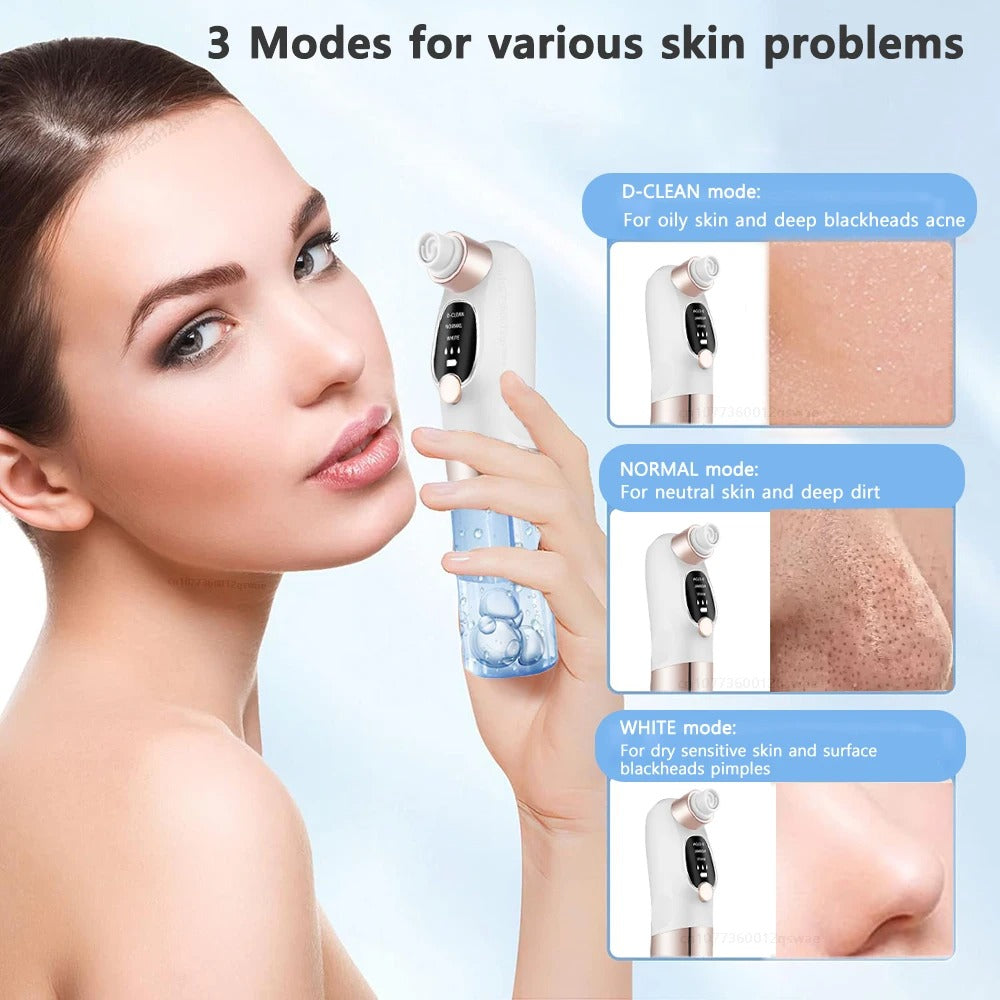 Electric Blackhead Remover Vacuum with Water Cycle System