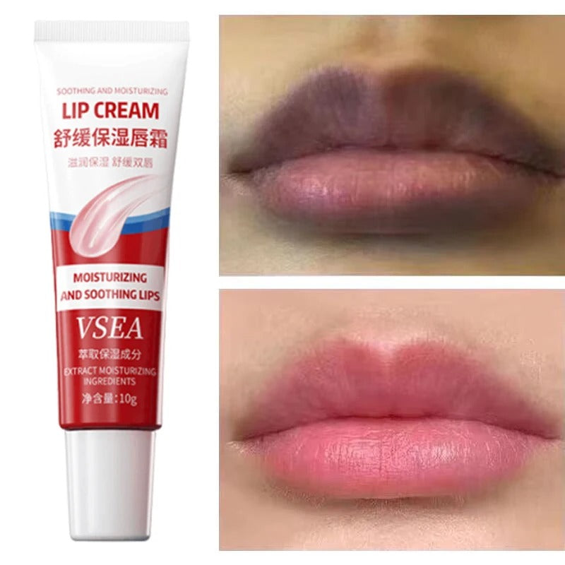 Dark Lip Lightening Balm – Pink Lip Exfoliator & Moisturizer for Dead Skin, Lip Line Fading & Hydration