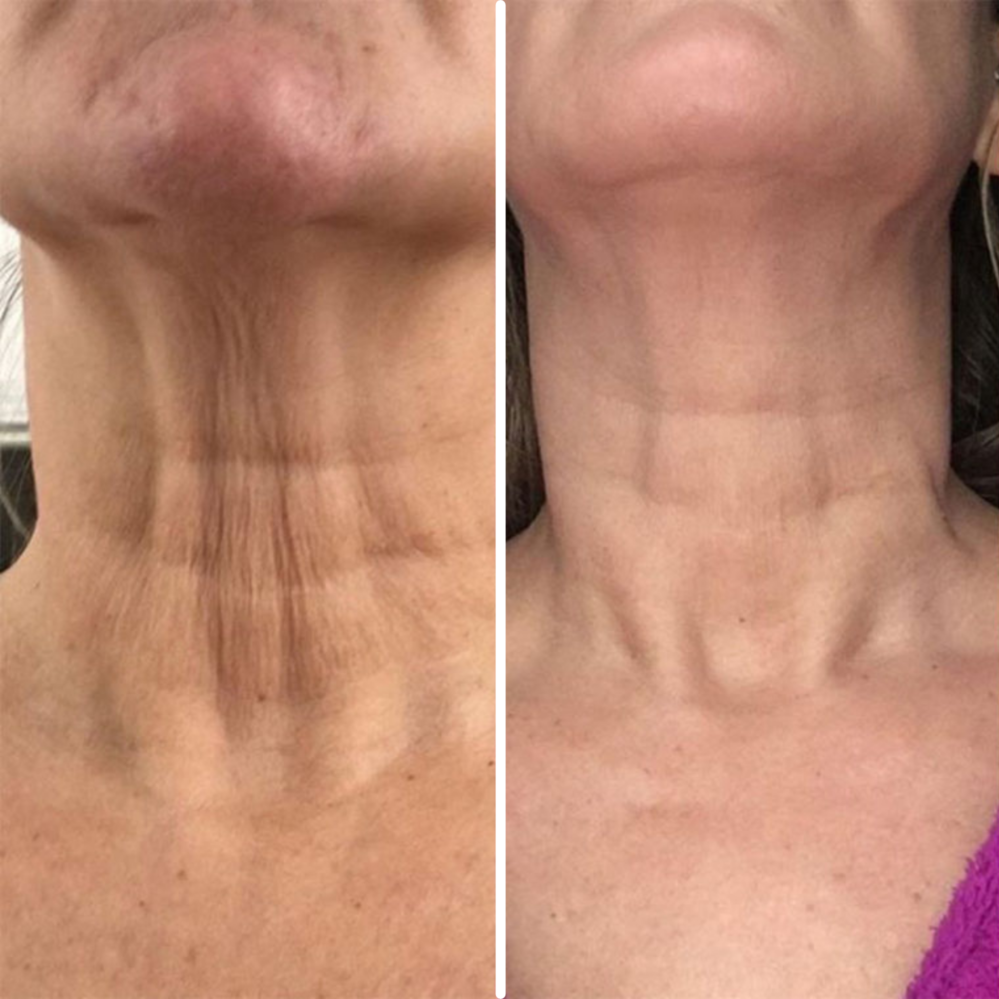 Age-Defying Neck Lift & Firm Cream (CLEARANCE SALE)