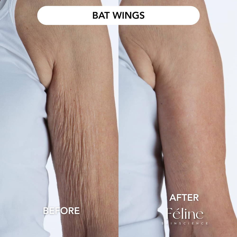 Advanced Crepe Fix | 1+1 FREE