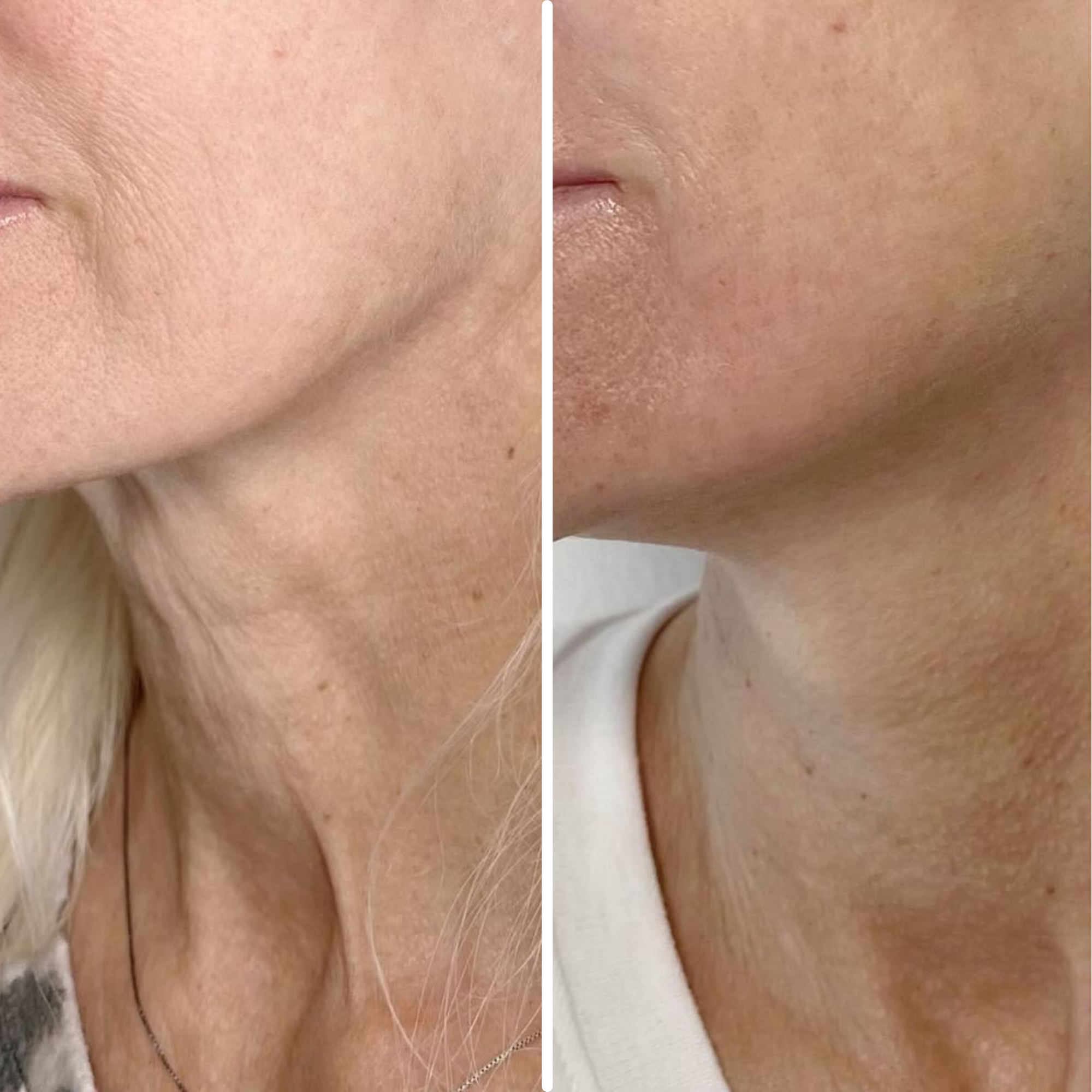 Age-Defying Neck Lift & Firm Cream (CLEARANCE SALE)