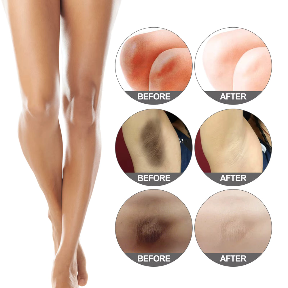 Brightening Snow Body Bleach Cream for Sensitive Areas
