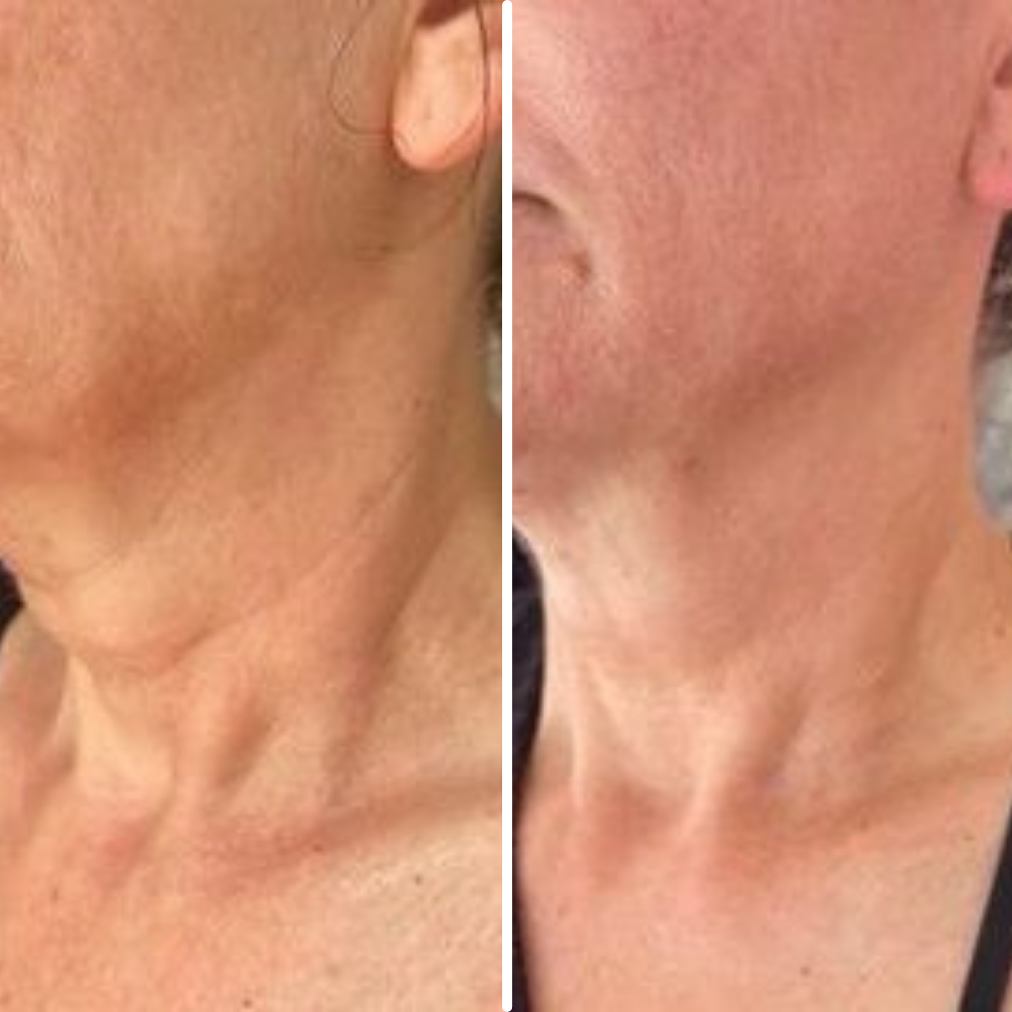 Age-Defying Neck Lift & Firm Cream (CLEARANCE SALE)