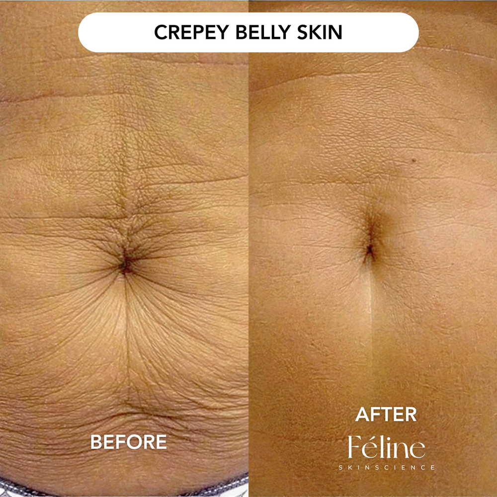 Advanced Crepe Fix | 1+1 FREE