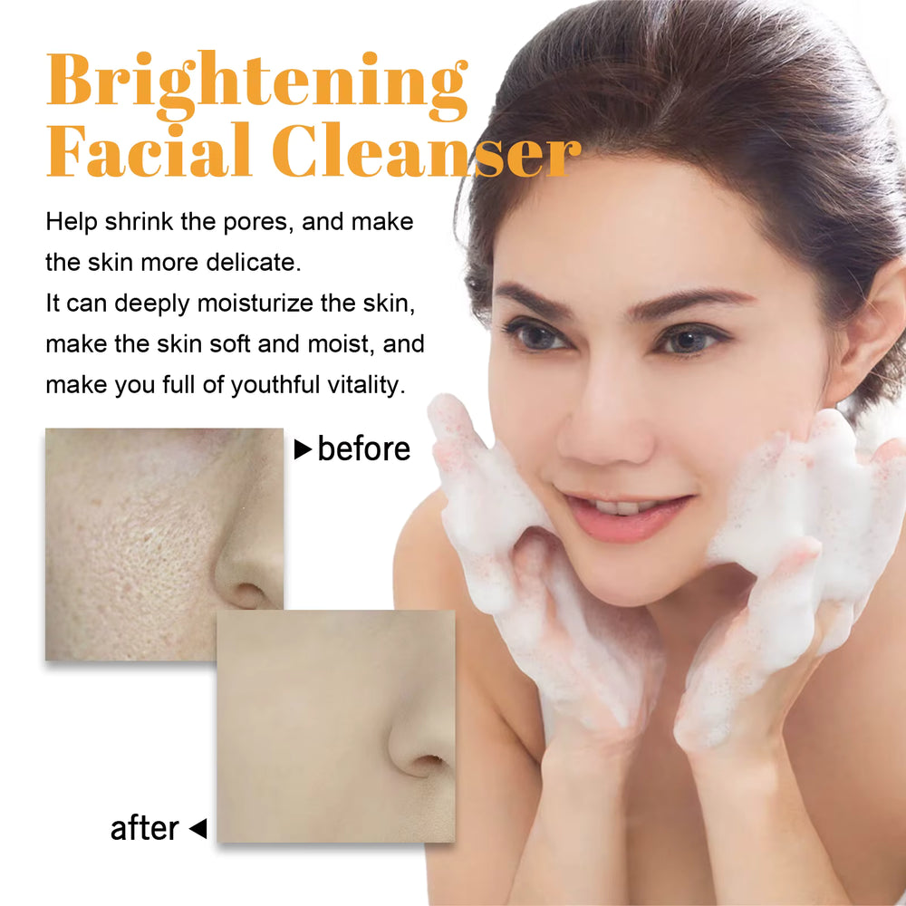 Turmeric Cleanser Foam | Blackheads Removal Facial Cleanser