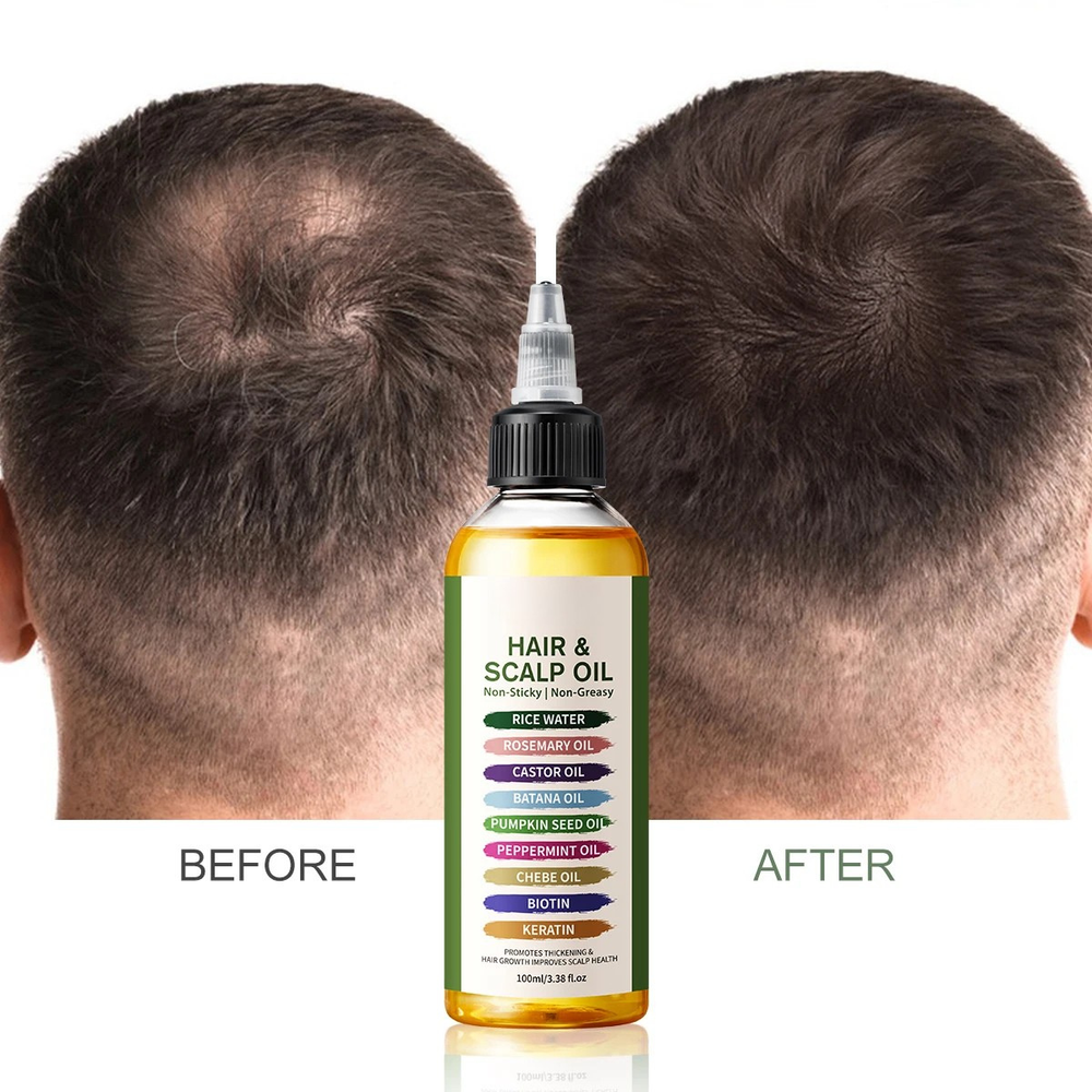 9 in 1 Biotin Peptide Hair Growth Serum Hair Growth Oil