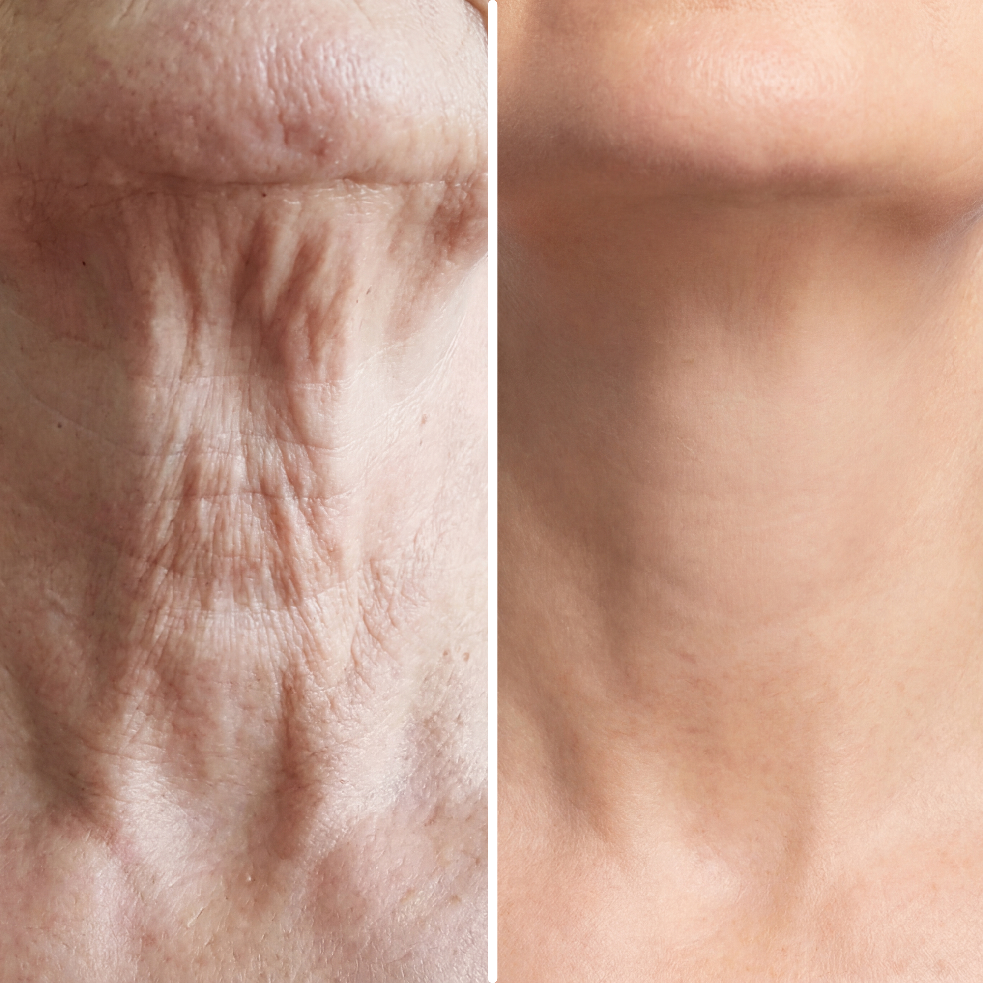Age-Defying Neck Lift & Firm Cream (CLEARANCE SALE)