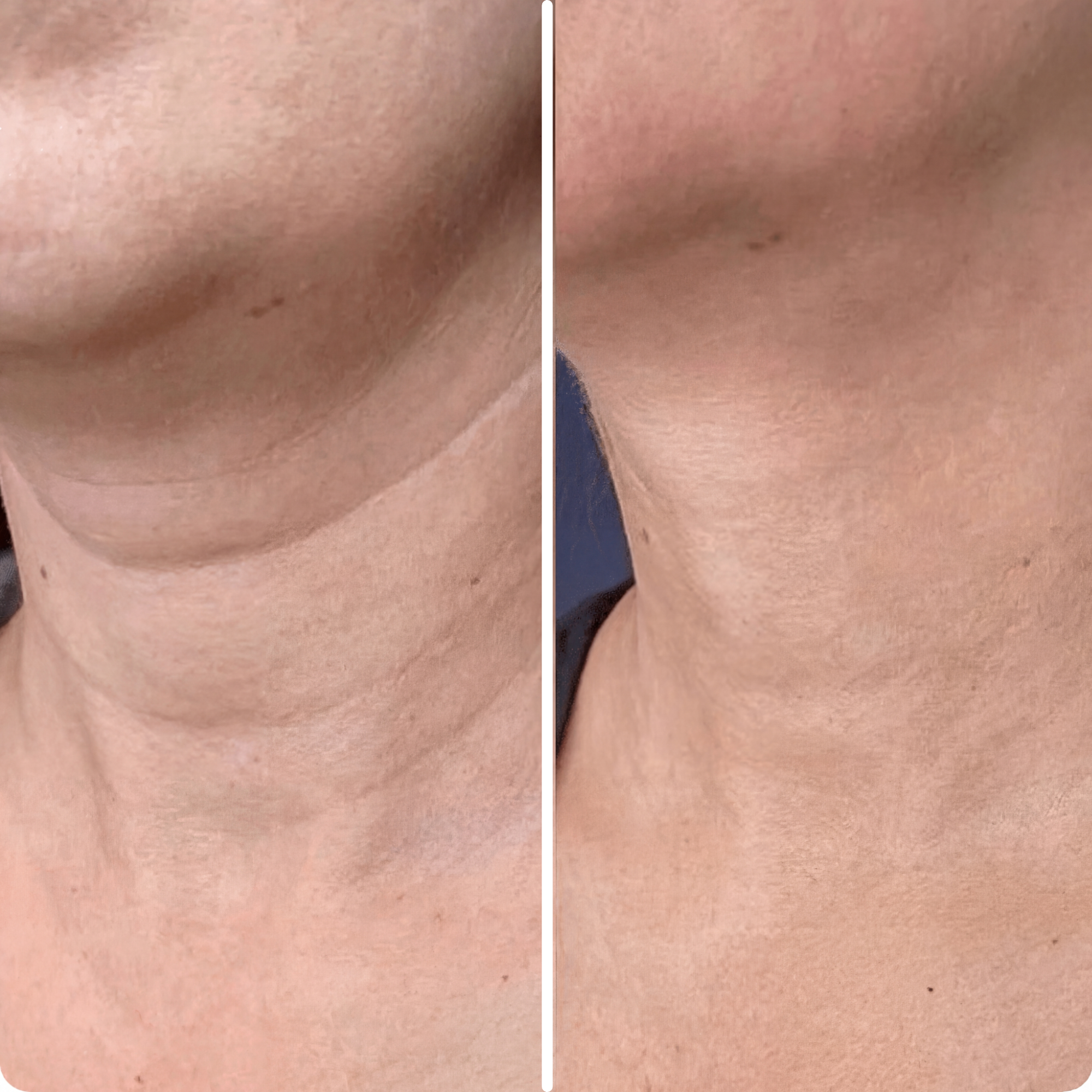 Age-Defying Neck Lift & Firm Cream (CLEARANCE SALE)
