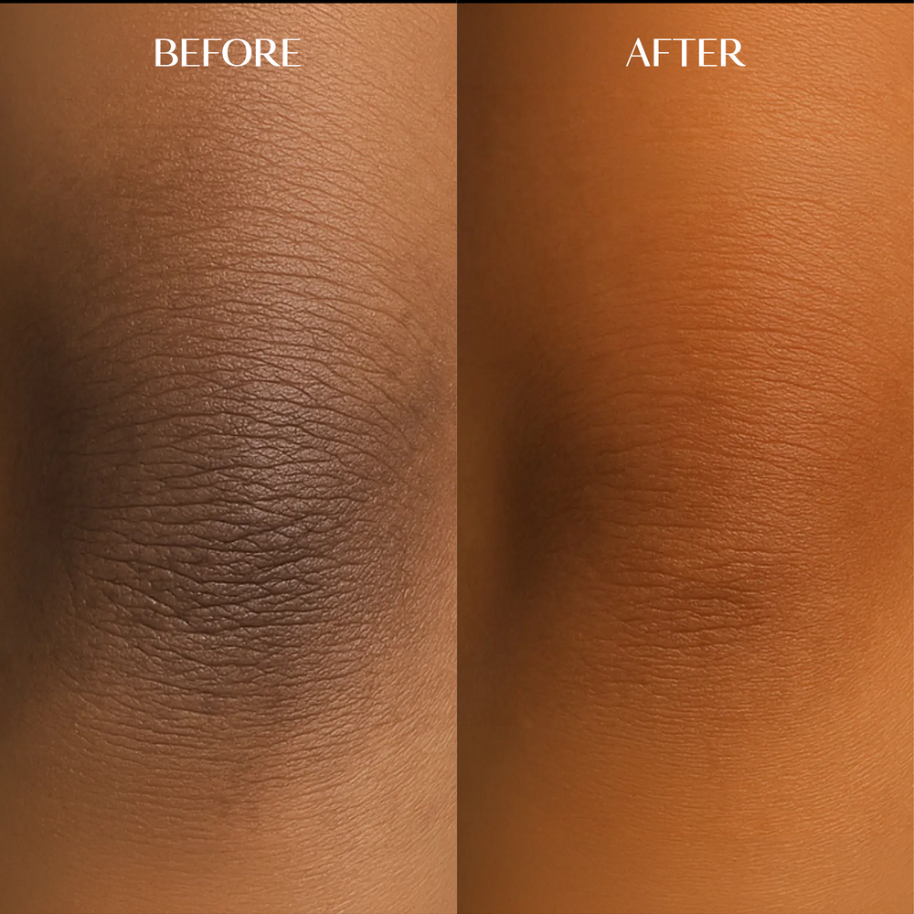 Melanin Dark Spot Corrector | 1+1 FREE