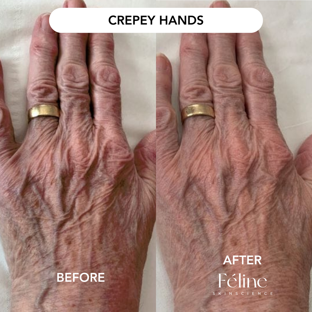 Advanced Crepe Fix | 1+1 FREE