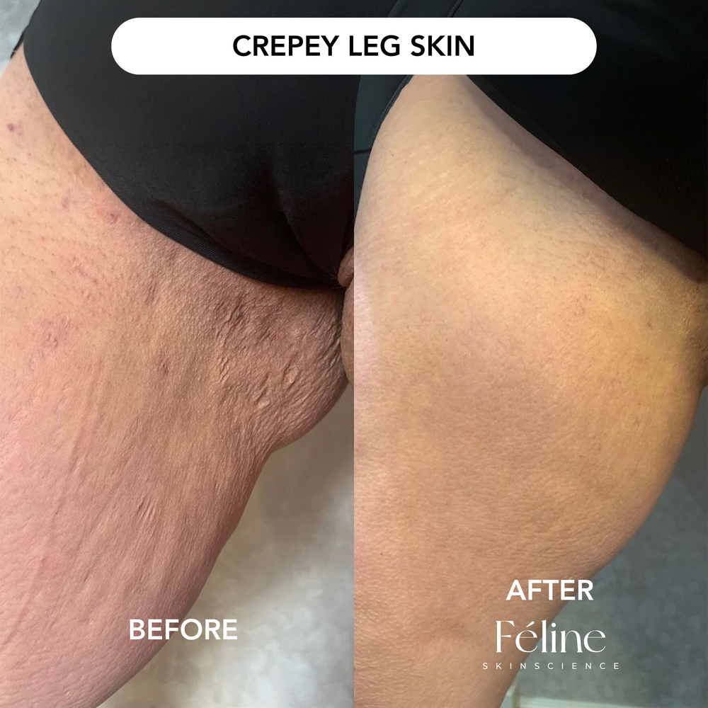 Advanced Crepe Fix | 1+1 FREE