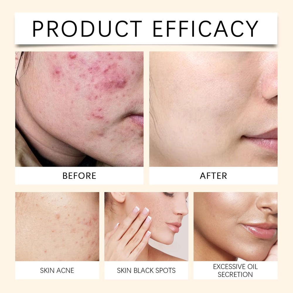 Soothing And Calming Redness Face Mist Spray Toner
