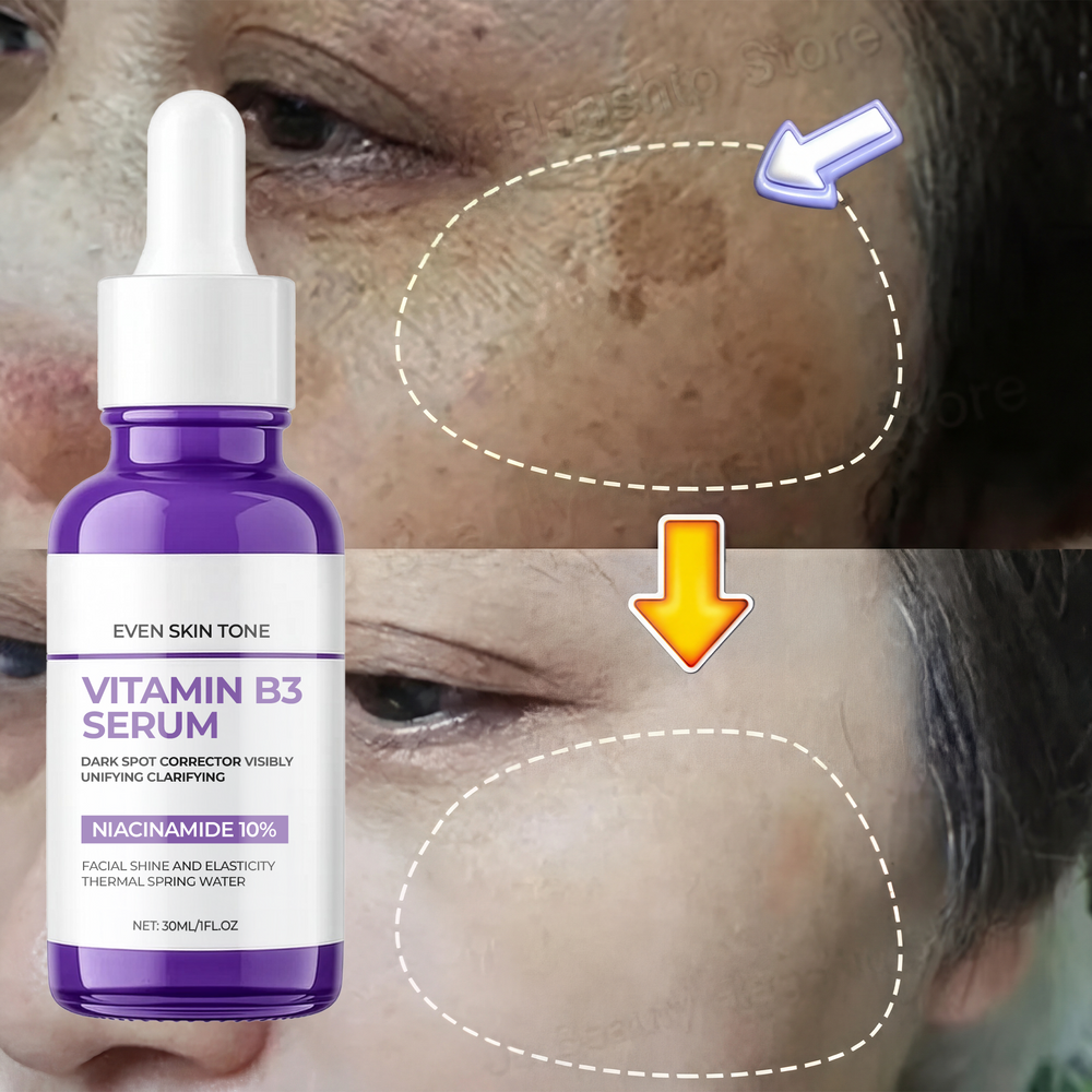 Dark Spot Remover Whitening Serum – Anti-Pigmentation & Brightening