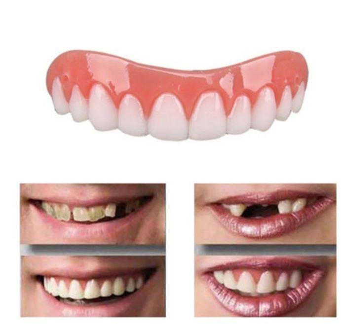 AureliaSmile | Innovative Comfortable Dental Cover for Flawless Teeth