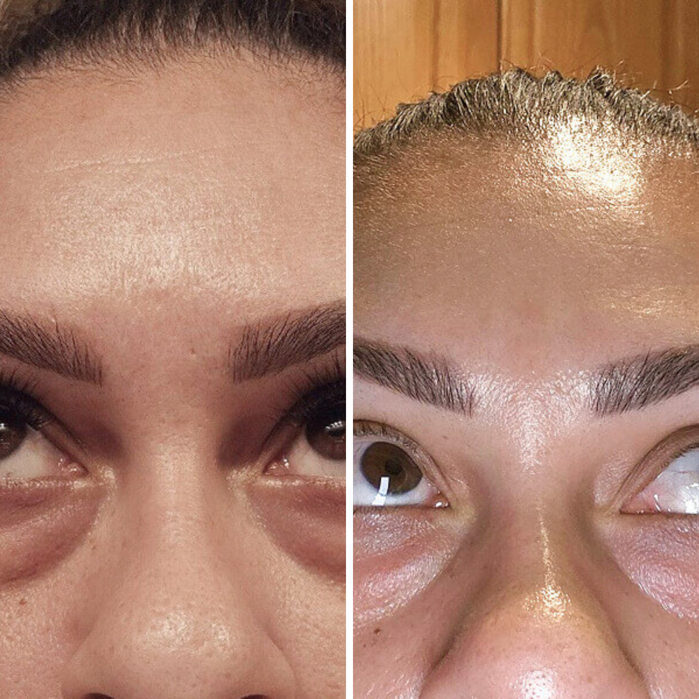 Dark Circle Corrector | 1+1 FREE