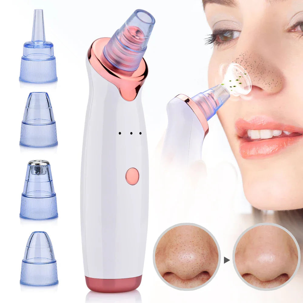Dermacleanse | Effective Gentle Blackhead Remover Vacuum Device