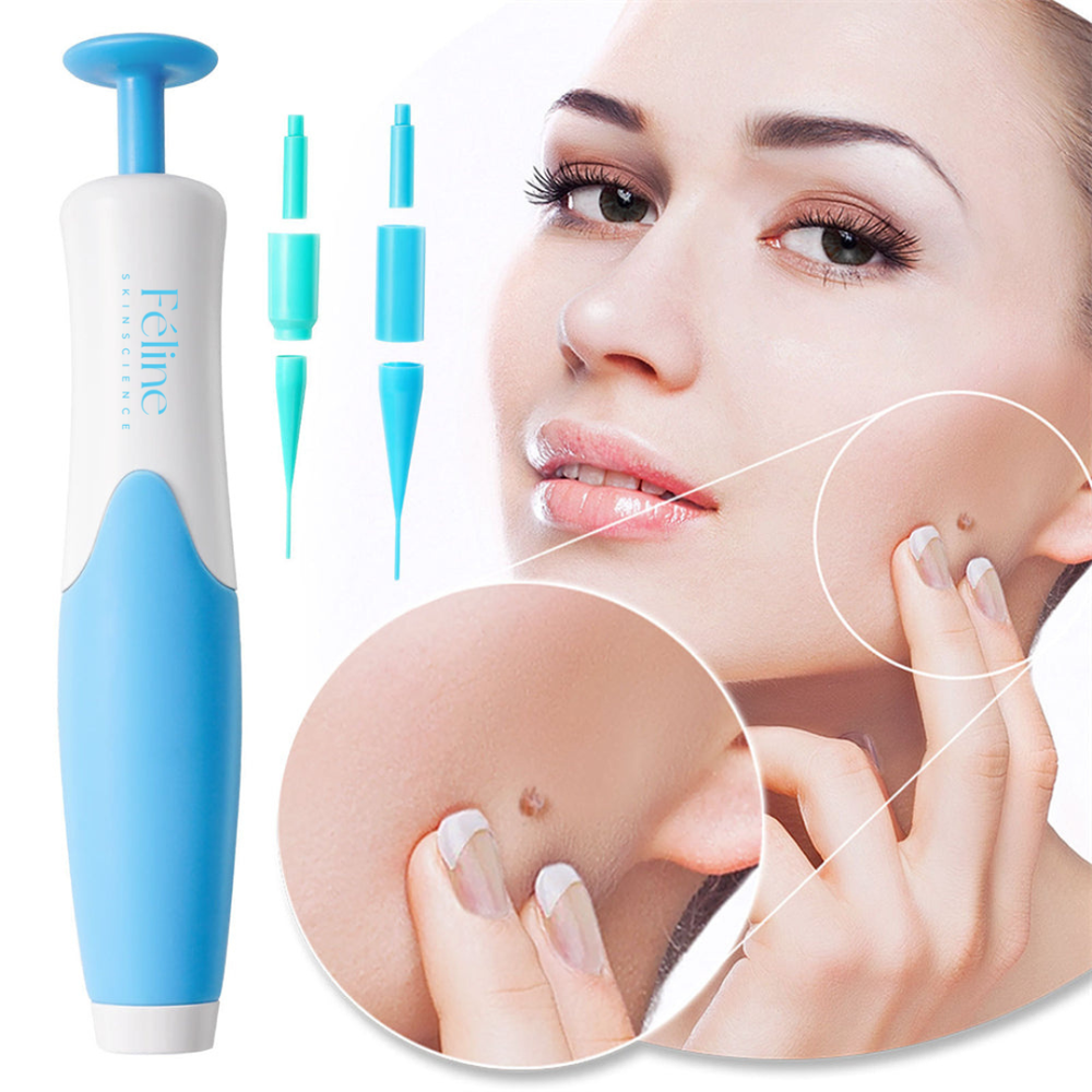 Skin Tag & Mole Remover Kit for Painless Treatment at Home